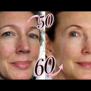 Better Skin At 60? 10-Year Retin-A Update!